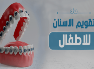 تقويم-الاسنان-للاطفال