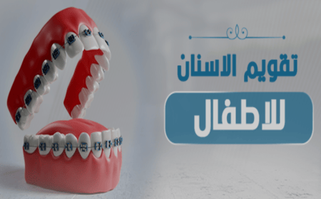 تقويم-الاسنان-للاطفال